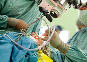 Some surgeries may lead to cognitive impairments